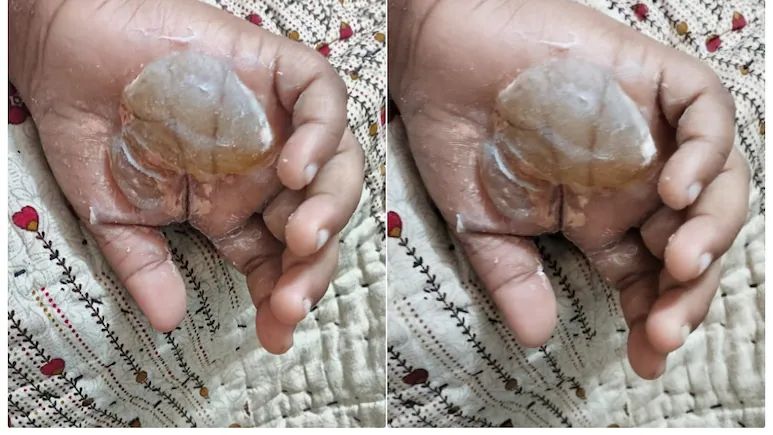 टीचर या जल्लाद! हैंडराइटिंग अच्छी नहीं होने पर पर ट्यूशन टीचर ने मासूम को दी खौफनाक सजा, जलती मोमबत्ती पर रख दिया हाथ, फिर जो हुआ.....