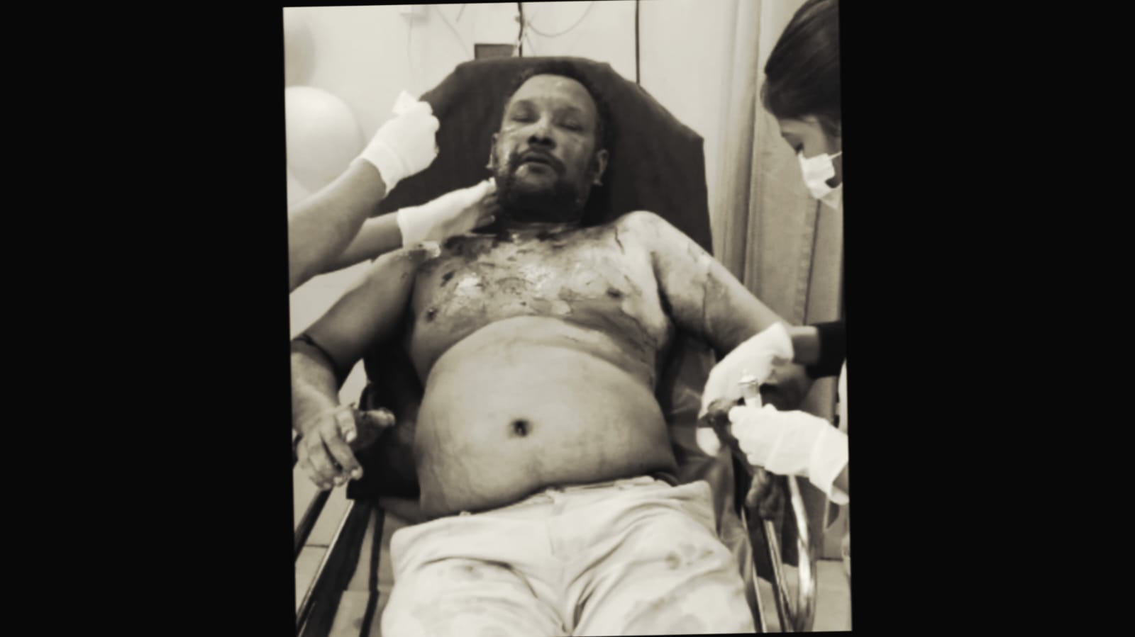 बड़ी खबर: JMM नेता की दबंगई! तीन लोगों पर पेट्रोल छिड़ककर लगाई आग, जानिए कहां का है मामला